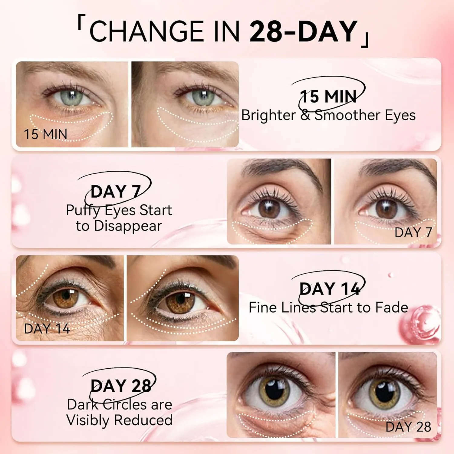 LANBENA Peptides Hydra-Gel Eye Patches for Dark Circles and Puffy Eyes, Reduce Under Eye Bags and Smooth Wrinkles, Anti-Aging, Eye Skin Care Pads With Soluble Collagen and Peptides-30 Pairs